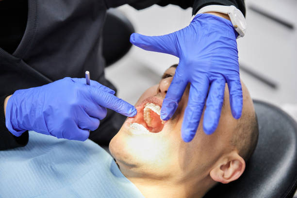 Best Emergency Dental Extractions in Sangaree, SC