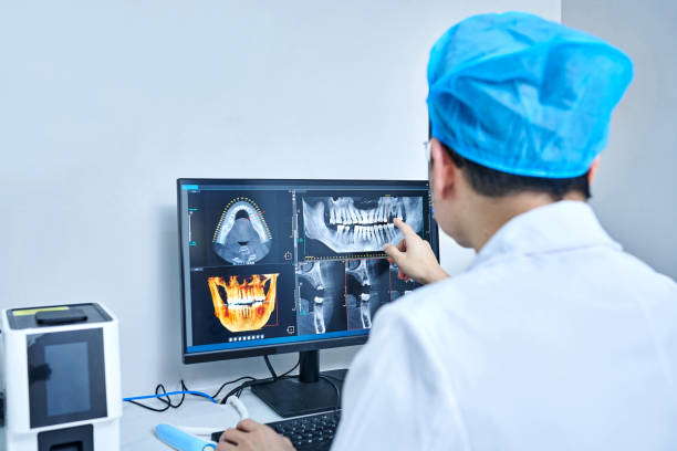 Best Emergency Root Canal Treatment in Sangaree, SC